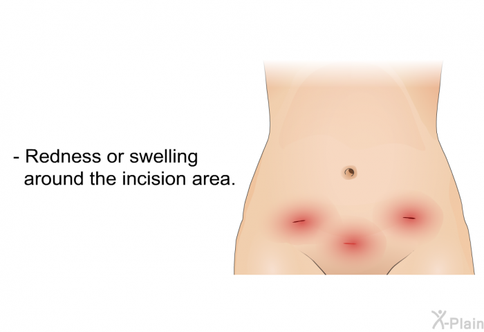 Redness or swelling around the incision area.