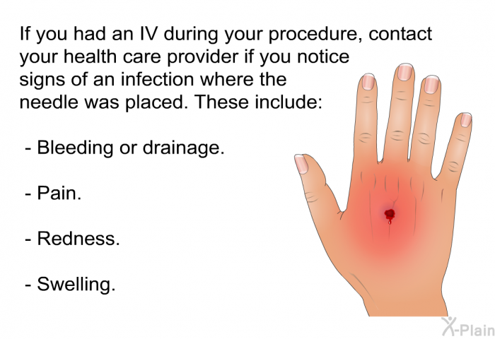 If you had an IV during your procedure, contact your health care provider if you notice signs of an infection where the needle was placed. These include:  Bleeding or drainage. Pain. Redness. Swelling.