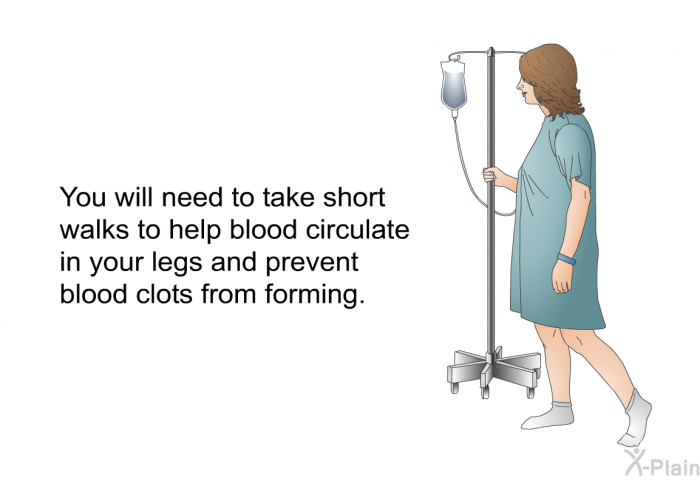 You will need to take short walks to help blood circulate in your legs and prevent blood clots from forming.