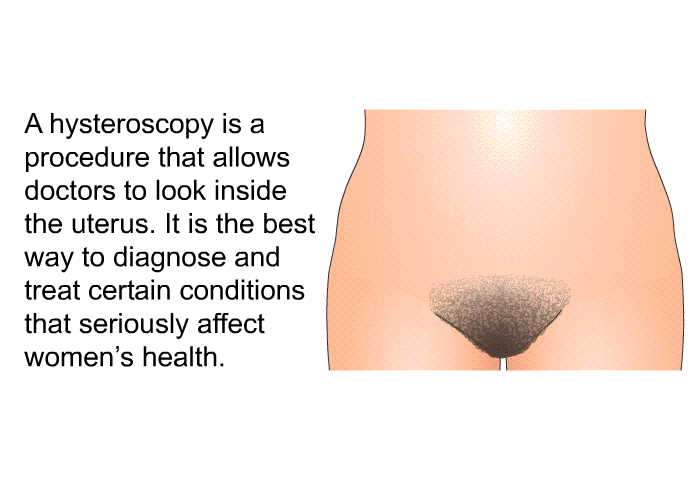 A hysteroscopy is a procedure that allows doctors to look inside the uterus. It is the best way to diagnose and treat certain conditions that seriously affect women's health.