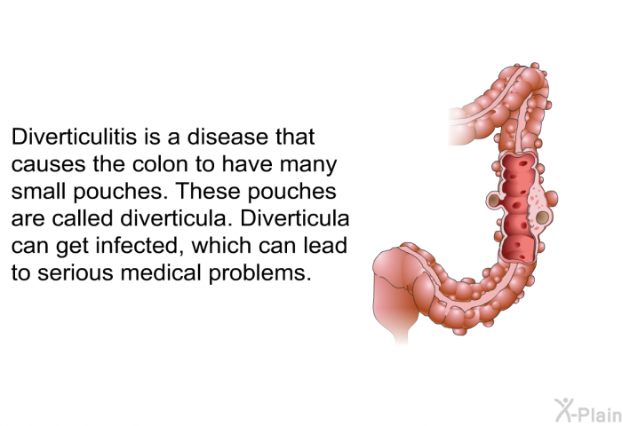 Diverticulitis is a disease that causes the colon to have many small pouches. These pouches are called diverticula. Diverticula can get infected, which can lead to serious medical problems.