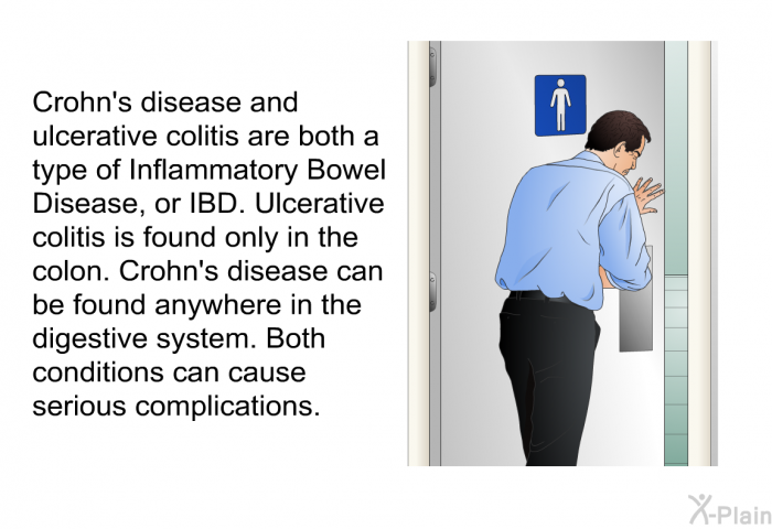 Crohn's disease and ulcerative colitis are both a type of Inflammatory Bowel Disease, or IBD. Ulcerative colitis is found only in the colon. Crohn's disease can be found anywhere in the digestive system. Both conditions can cause serious complications.