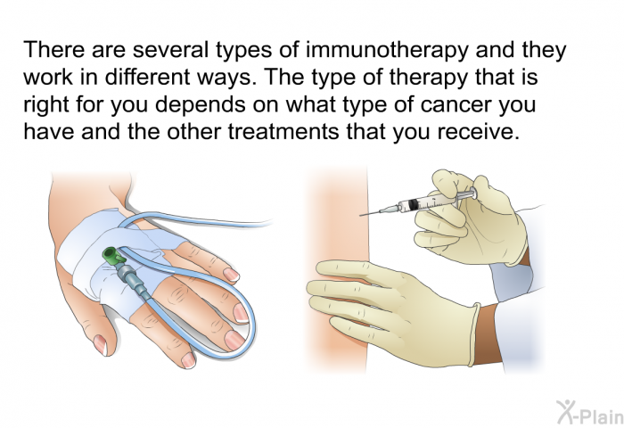 There are several types of immunotherapy and they work in different ways. The type of therapy that is right for you depends on what type of cancer you have and the other treatments that you receive.