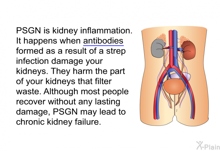 PSGN is kidney inflammation. It happens when <U>antibodies</U> formed as a result of a strep infection damage your kidneys. They harm the part of your kidneys that filter waste. Although most people recover without any lasting damage, PSGN may lead to chronic kidney failure.
