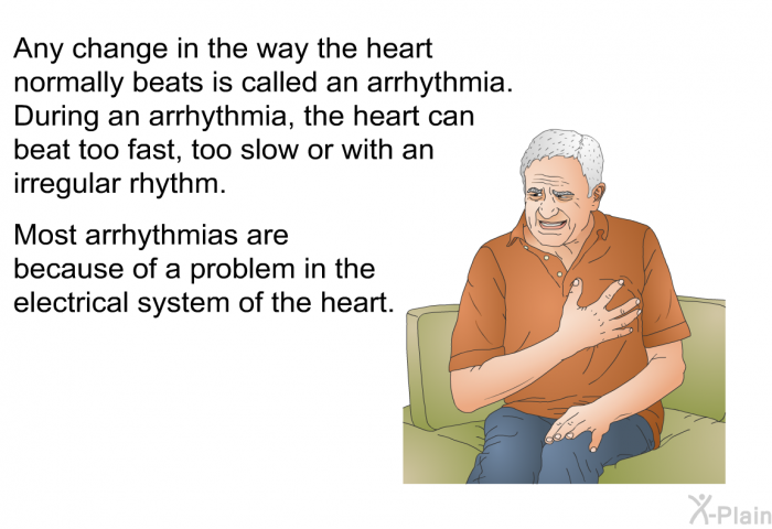 Any change in the way the heart normally beats is called an arrhythmia. During an arrhythmia, the heart can beat too fast, too slow or with an irregular rhythm. Most arrhythmias are because of a problem in the electrical system of the heart.