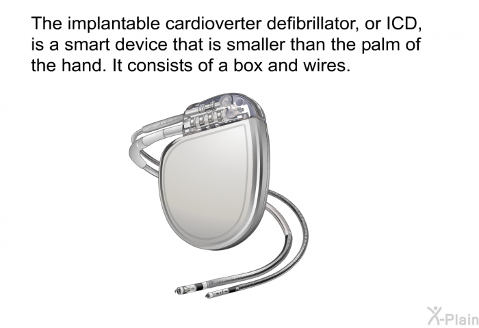 The implantable cardioverter defibrillator, or ICD, is a smart device that is smaller than the palm of the hand. It consists of a box and wires.