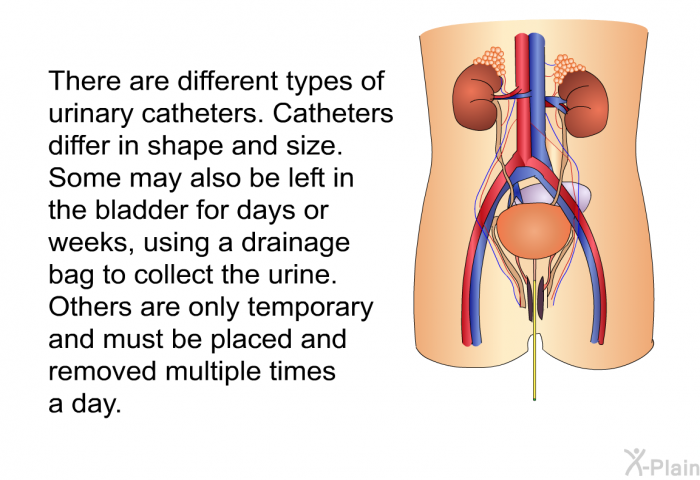 There are different types of urinary catheters. Catheters differ in shape and size. Some may also be left in the bladder for days or weeks, using a drainage bag to collect the urine. Others are only temporary and must be placed and removed multiple times a day.