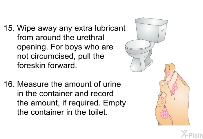 <OL START=18> Wipe away any extra lubricant from around the urethral opening. For boys who are not circumcised, pull the foreskin forward. Measure the amount of urine in the container and record the amount, if required. Empty the container in the toilet.