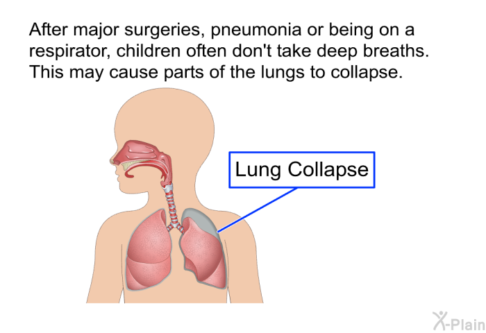 After major surgeries, pneumonia or being on a respirator, children often don't take deep breaths. This may cause parts of the lungs to collapse.
