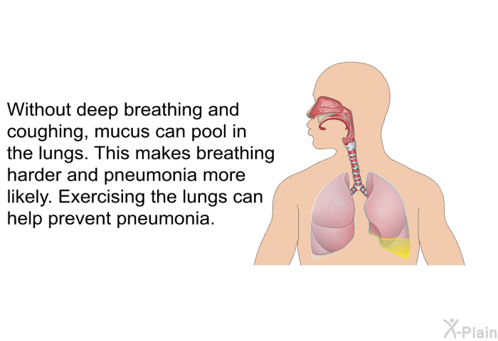 Without deep breathing and coughing, mucus can pool in the lungs. This makes breathing harder and pneumonia more likely. Exercising the lungs can help prevent pneumonia.