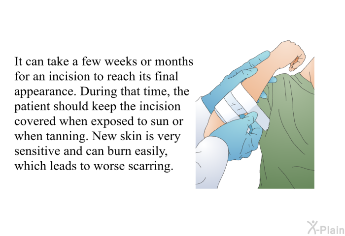 It can take a few weeks or months for an incision to reach its final appearance. During that time, the patient should keep the incision covered when exposed to sun or when tanning. New skin is very sensitive and can burn easily, which leads to worse scarring.