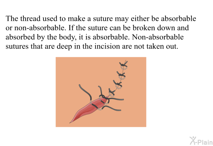 The thread used to make a suture may either be absorbable or non-absorbable. If the suture can be broken down and absorbed by the body, it is absorbable. Non-absorbable sutures that are deep in the incision are not taken out.