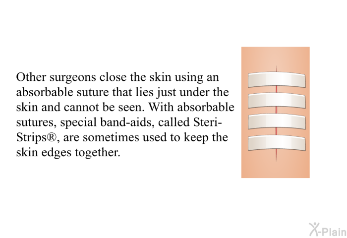 Other surgeons close the skin using an absorbable suture that lies just under the skin and cannot be seen. With absorbable sutures, special band-aids, called Steri-Strips , are sometimes used to keep the skin edges together.