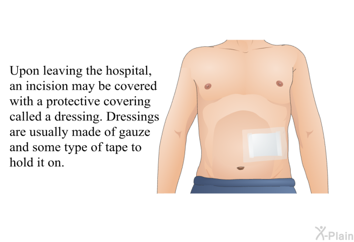 Upon leaving the hospital, an incision may be covered with a protective covering called a dressing. Dressings are usually made of gauze and some type of tape to hold it on.