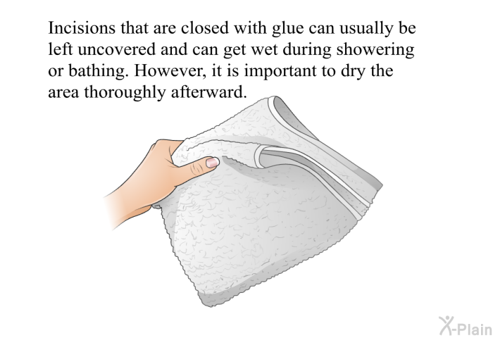 Incisions that are closed with glue can usually be left uncovered and can get wet during showering or bathing. However, it is important to dry the area thoroughly afterward.