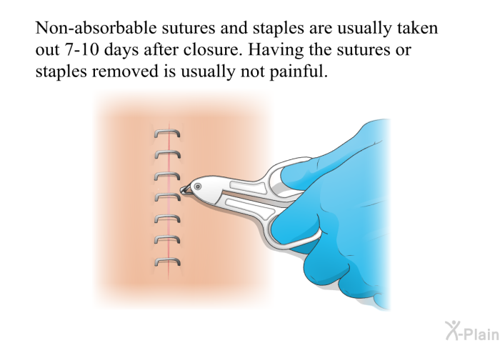 Non-absorbable sutures and staples are usually taken out 7-10 days after closure. Having the sutures or staples removed is usually not painful.