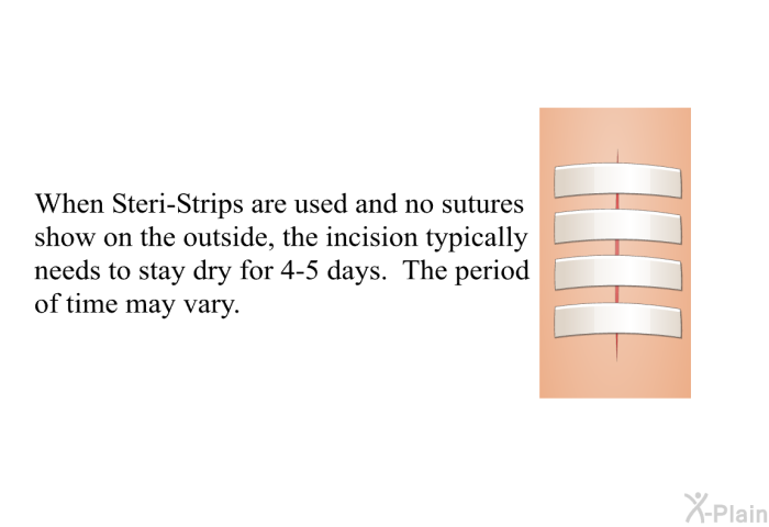 When Steri-Strips are used and no sutures show on the outside, the incision typically needs to stay dry for 4-5 days. The period of time may vary.
