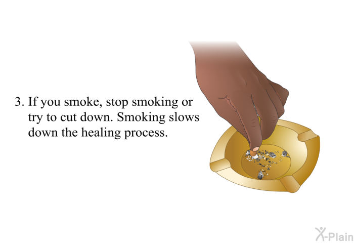 If you smoke, stop smoking or try to cut down. Smoking slows down the healing process.