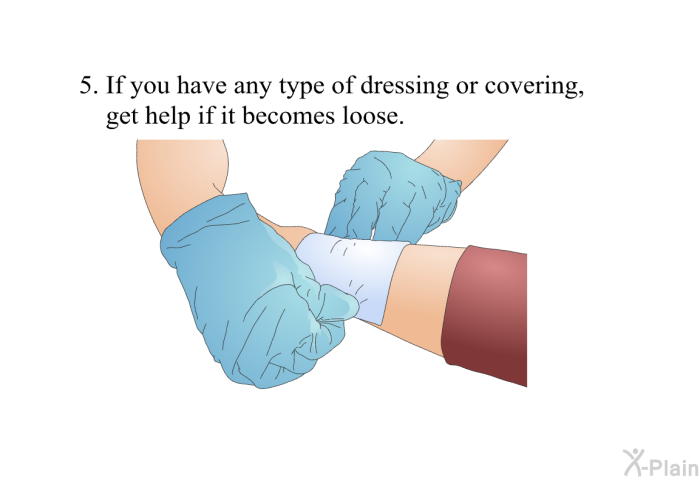 If you have any type of dressing or covering, get help if it becomes loose.