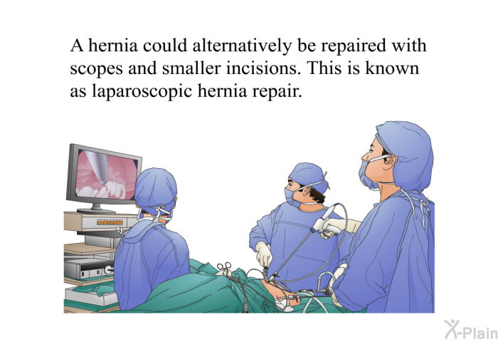 A hernia could alternatively be repaired with scopes and smaller incisions. This is known as laparoscopic hernia repair.