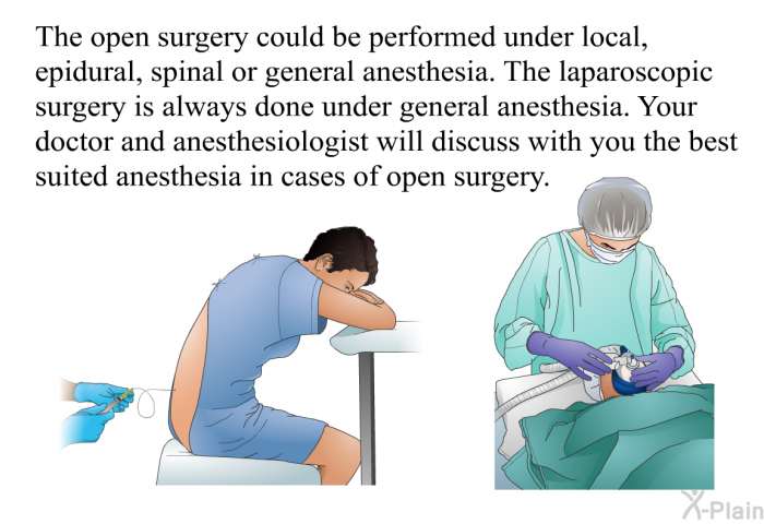 The open surgery could be performed under local, epidural, spinal or general anesthesia. The laparoscopic surgery is always done under general anesthesia. Your doctor and anesthesiologist will discuss with you the best suited anesthesia in cases of open surgery.