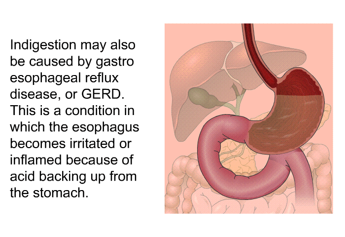 Indigestion may also be caused by gastro esophageal reflux disease, or GERD. This is a condition in which the esophagus becomes irritated or inflamed because of acid backing up from the stomach.