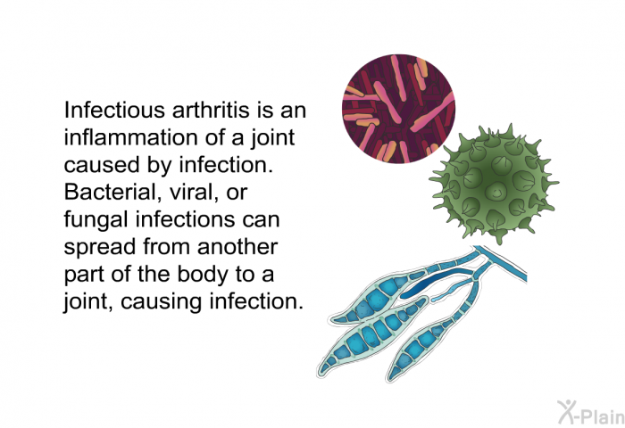 Infectious arthritis is an inflammation of a joint caused by infection. Bacterial, viral, or fungal infections can spread from another part of the body to a joint, causing infection.