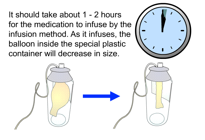 It should take about 1 – 2 hours for the medication to infuse by the infusion method. As it infuses, the balloon inside the special plastic container will decrease in size.