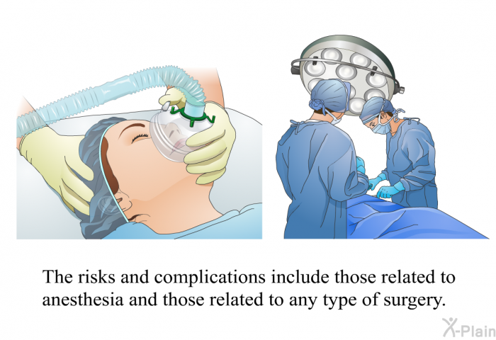 The risks and complications include those related to anesthesia and those related to any type of surgery.
