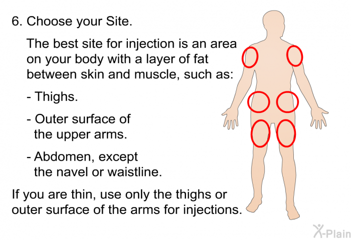 Choose Your Site.  The best site for injection is an area on your body with a layer of fat between skin and muscle, such as:  Thighs. Outer surface of the upper arms. Abdomen, except the navel or waistline.  
If you are thin, use only the thighs or outer surface of the arms for injections.