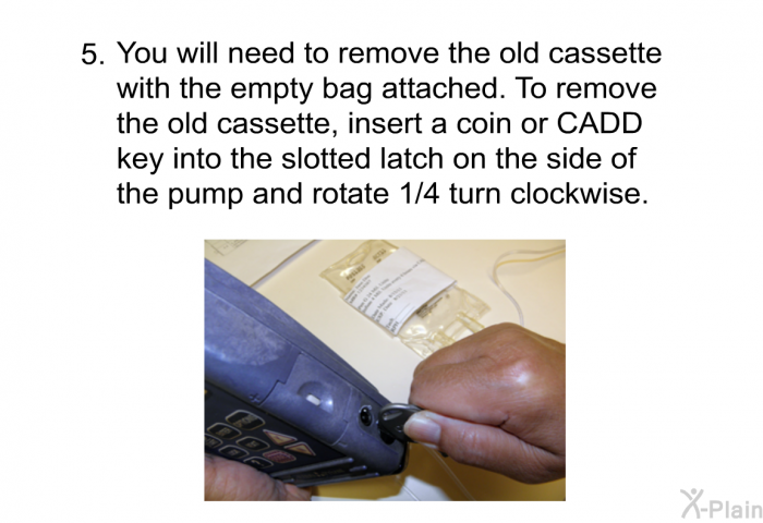 You will need to remove the old cassette with the empty bag attached. To remove the old cassette, insert a coin or CADD key into the slotted latch on the side of the pump and rotate 1/4 turn clockwise.