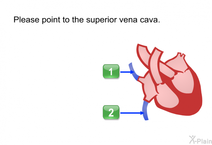 Please point to the superior vena cava. Press A or B