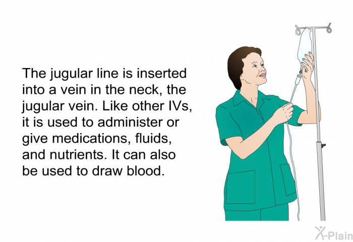 The jugular line is inserted into a vein in the neck, the jugular vein. Like other IVs, it is used to administer or give medications, fluids, and nutrients. It can also be used to draw blood.