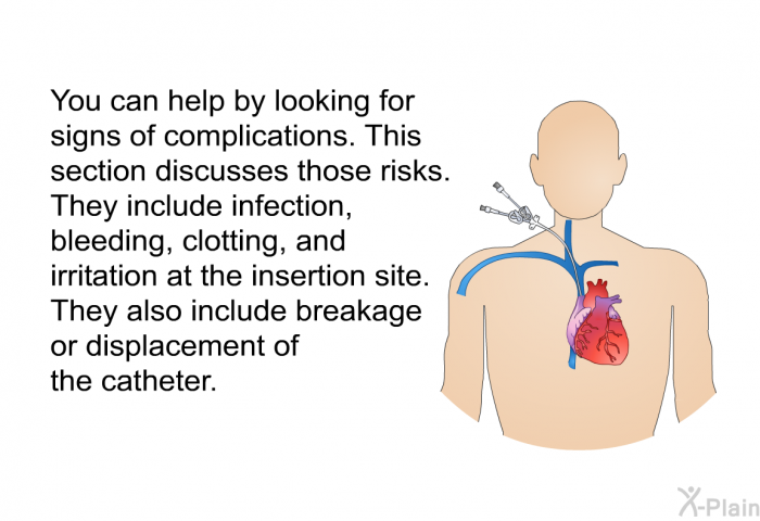 You can help by looking for signs of complications. This section discusses those risks. They include infection, bleeding, clotting, and irritation at the insertion site. They also include breakage or displacement of the catheter.