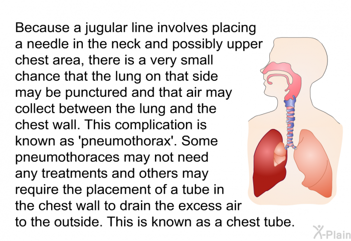Because a jugular line involves placing a needle in the neck and possibly upper chest area, there is a very small chance that the lung on that side may be punctured and that air may collect between the lung and the chest wall. This complication is known as  pneumothorax'. Some pneumothoraces may not need any treatments and others may require the placement of a tube in the chest wall to drain the excess air to the outside. This is known as a chest tube.