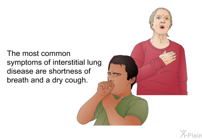 The most common symptoms of interstitial lung disease are shortness of breath and a dry cough.