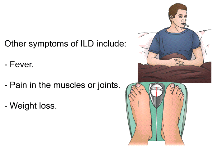 Other symptoms of ILD include:  Fever. Pain in the muscles or joints. Weight loss.