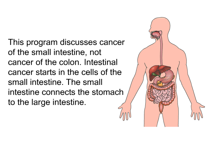 This health information discusses cancer of the small intestine, not cancer of the colon. Intestinal cancer starts in the cells of the small intestine. The small intestine connects the stomach to the large intestine.