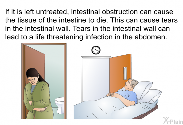 If it is left untreated, intestinal obstruction can cause the tissue of the intestine to die. This can cause tears in the intestinal wall. Tears in the intestinal wall can lead to a life threatening infection in the abdomen.