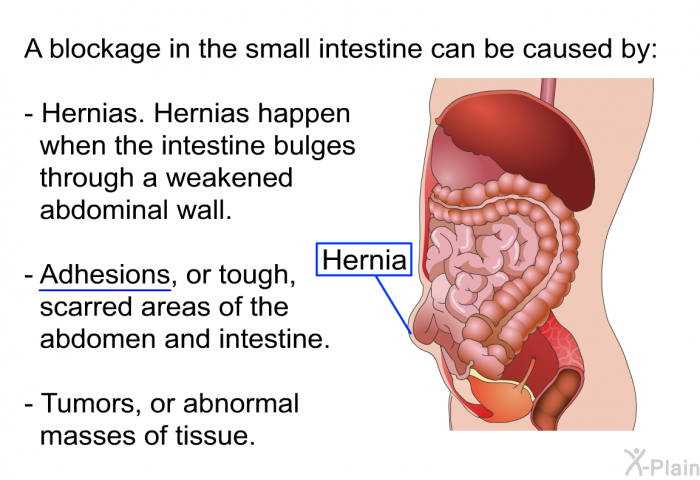 A blockage in the small intestine can be caused by:  Hernias. Hernias happen when the intestine bulges through a weakened abdominal wall. Adhesions, or tough, scarred areas of the abdomen and intestine. Tumors, or abnormal masses of tissue.