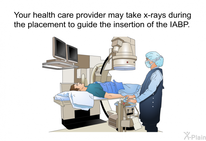 Your health care provider may take x-rays during the placement to guide the insertion of the IABP.
