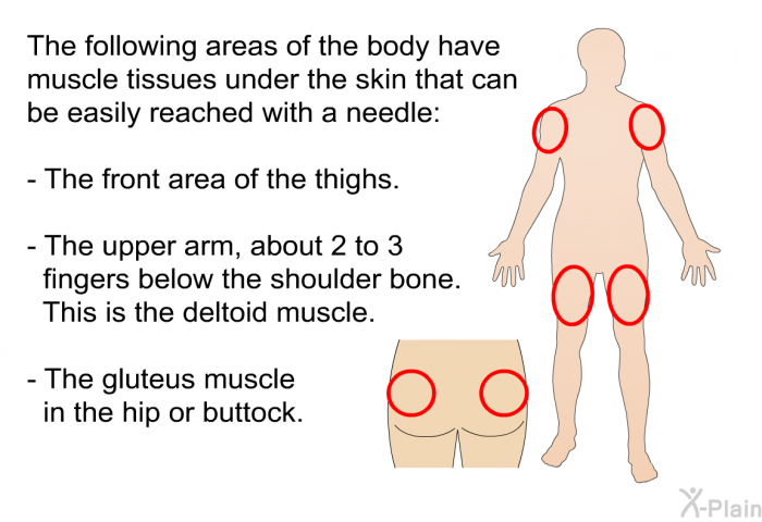 The following areas of the body have muscle tissues under the skin that can be easily reached with a needle:  The front area of the thighs. The upper arm, about 2 to 3 fingers below the shoulder bone. This is the deltoid muscle. The gluteus muscle in the hip or buttock.