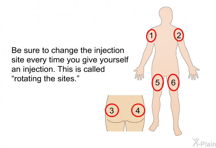 Be sure to change the injection site every time you give yourself an injection. This is called “rotating the sites.”