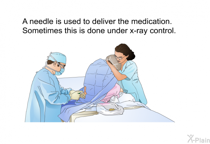A needle is used to deliver the medication. Sometimes this is done under x-ray control.