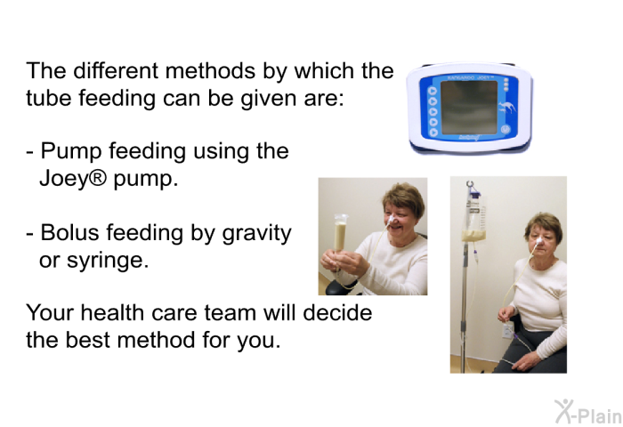 The different methods by which the tube feeding can be given are:  Pump feeding using the Joey  pump. Bolus feeding by gravity or syringe.  
 Your health care team will decide the best method for you.