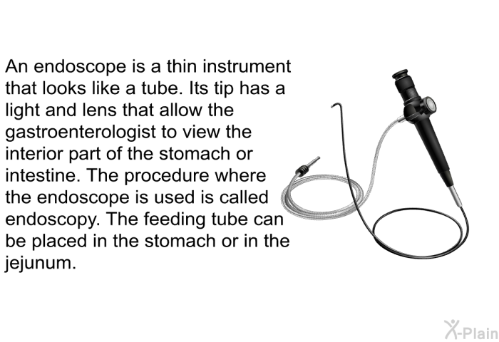 An endoscope is a thin instrument that looks like a tube. Its tip has a light and lens that allow the gastroenterologist to view the interior part of the stomach or intestine. The procedure where the endoscope is used is called endoscopy. The feeding tube can be placed in the stomach or in the jejunum.