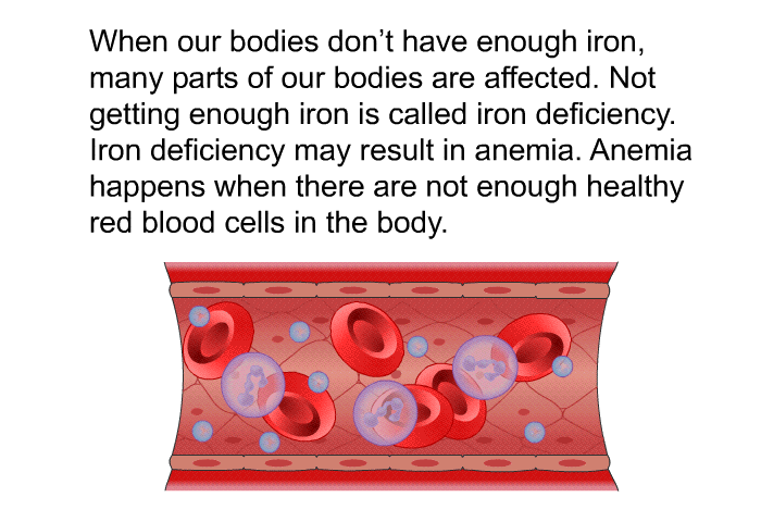 When our bodies don't have enough iron, many parts of our bodies are affected. Not getting enough iron is called iron deficiency. Iron deficiency may result in anemia. Anemia happens when there are not enough healthy red blood cells in the body.