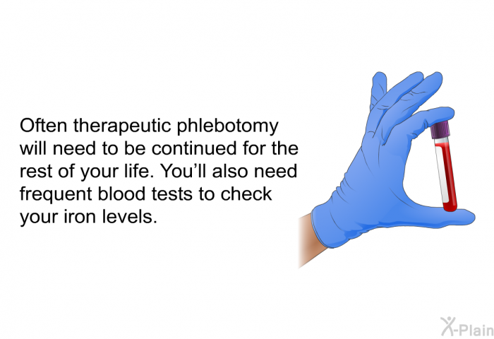 Often therapeutic phlebotomy will need to be continued for the rest of your life. You'll also need frequent blood tests to check your iron levels.