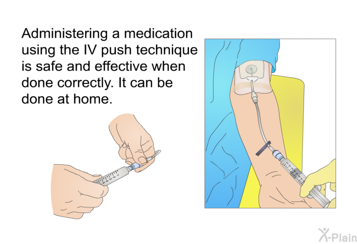 Administering a medication using the IV push technique is safe and effective when done correctly. It can be done at home.