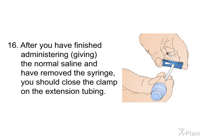 <OL START=16> After you have finished administering (giving) the normal saline and have removed the syringe, you should close the clamp on the extension tubing.